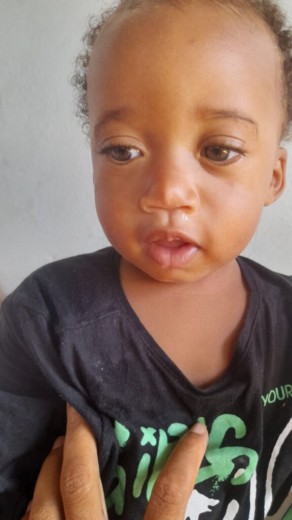 Kezideki today runny nose. Kezi today extra tender, extra clingy most remarkable eyes, deep navy blue in the center, green-yellow and rimed with platinum.